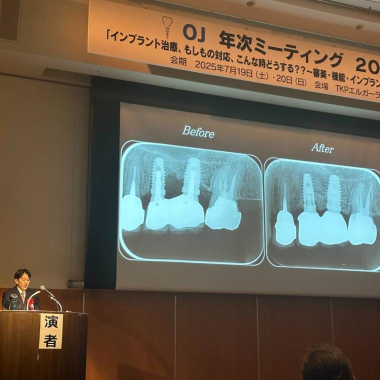 OJ 年次ミーティング2025　講演