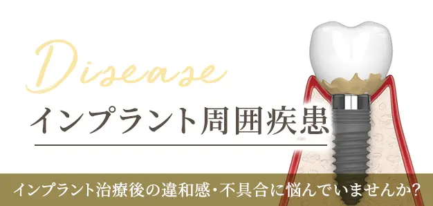 インプラント治療後の違和感・不具合に悩んでいませんか？　インプラント周囲疾患