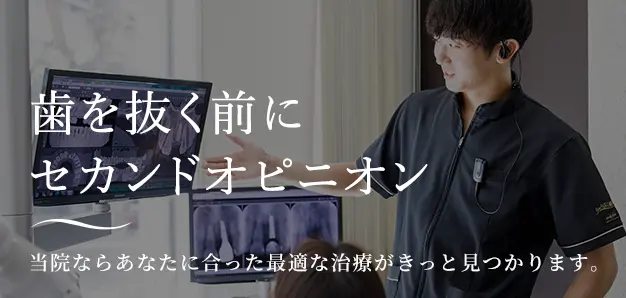 歯を抜く前にセカンドオピニオン